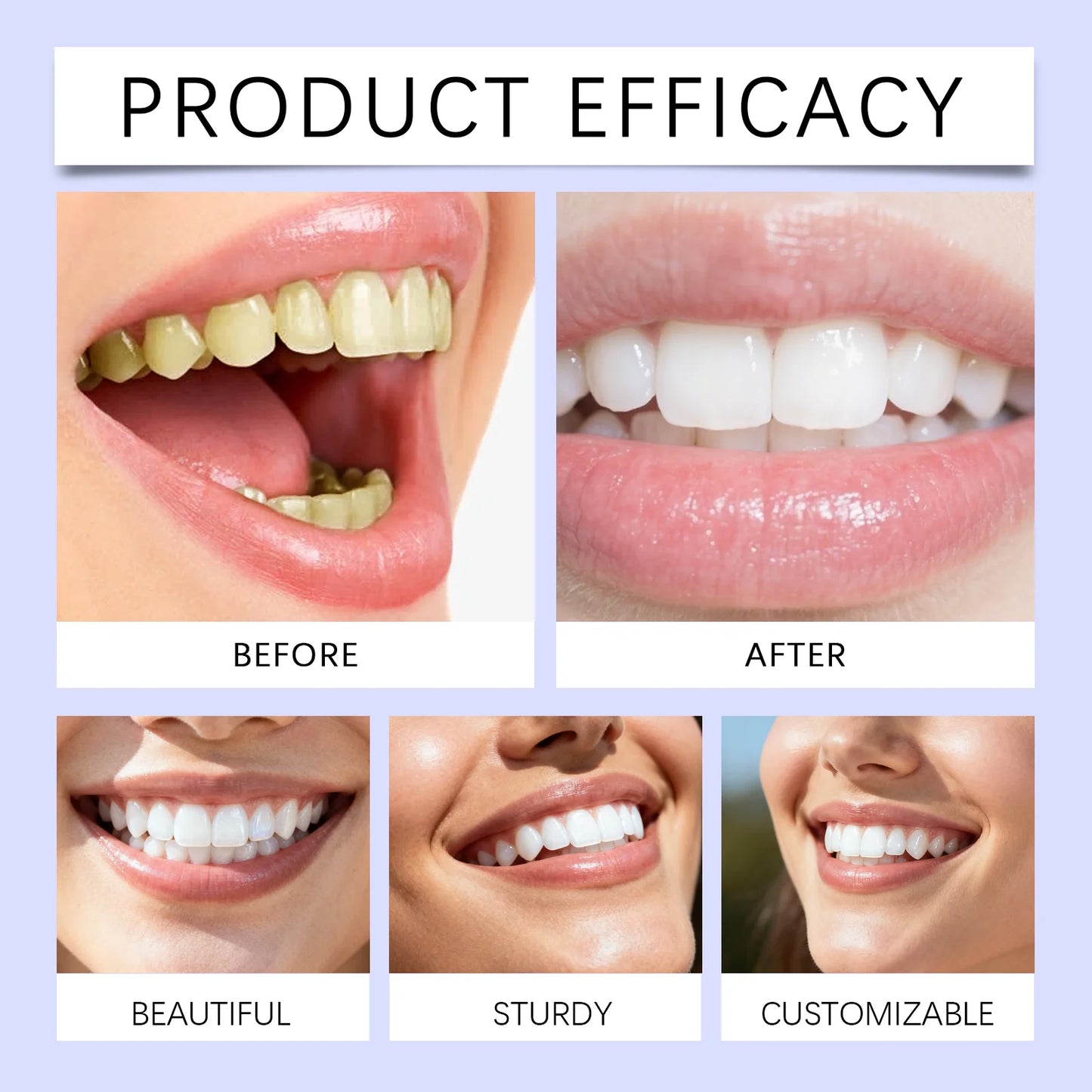PrettyxMuch™ Teeth Whitening Strips ( BE FAST ‼️)